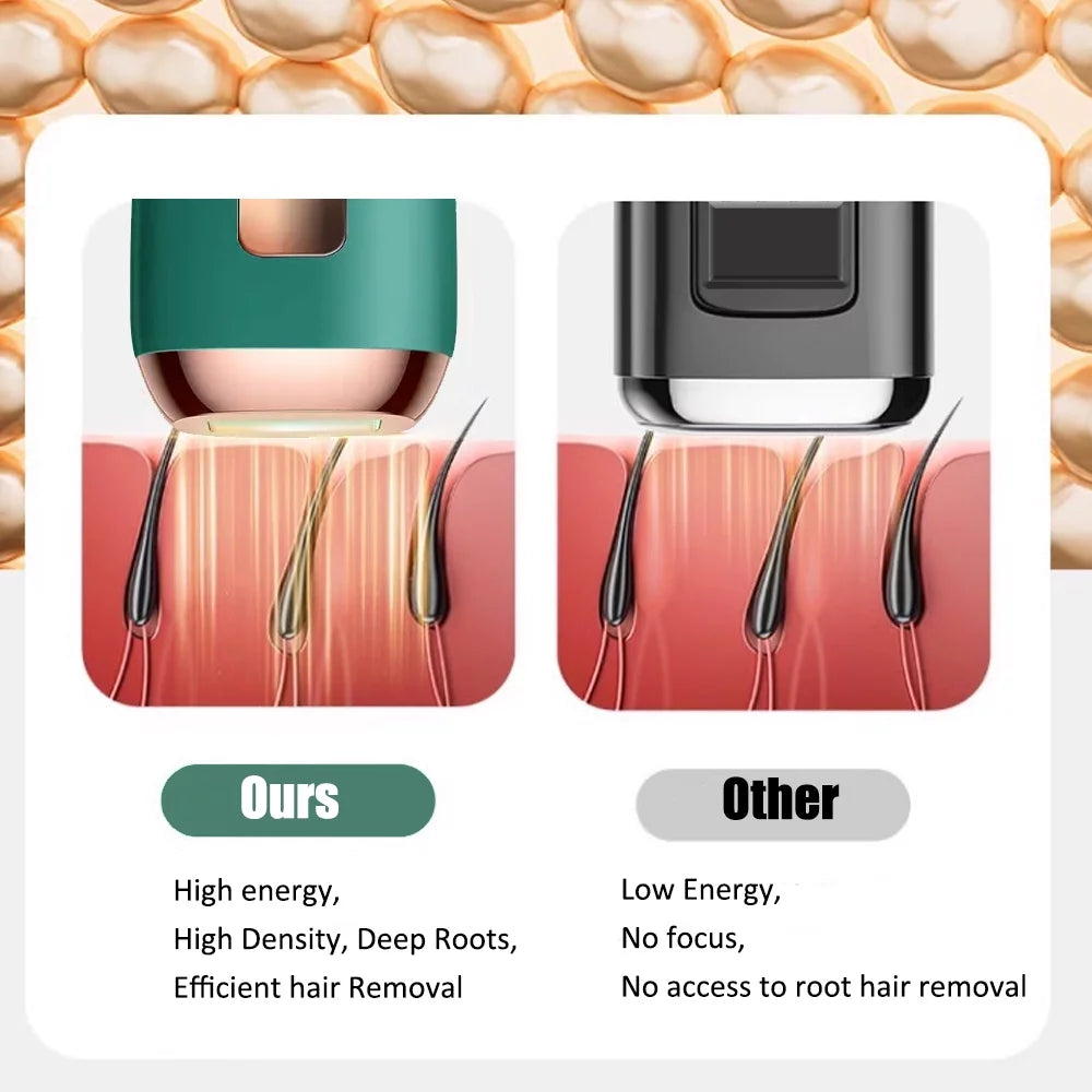 GlowErase Pro — How IPL Technology Works
